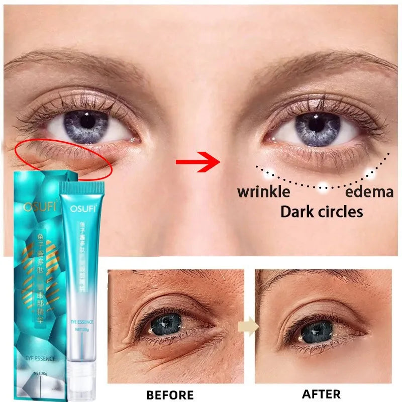 Creme antirrugas para os olhos eliminando os círculos escuros e bolsas dos olhos - 7 Dias
