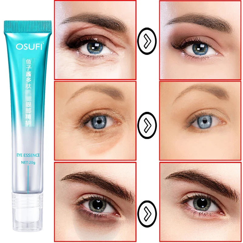 Creme antirrugas para os olhos eliminando os círculos escuros e bolsas dos olhos - 7 Dias